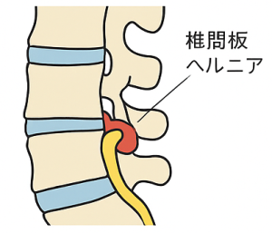 イラスト１
